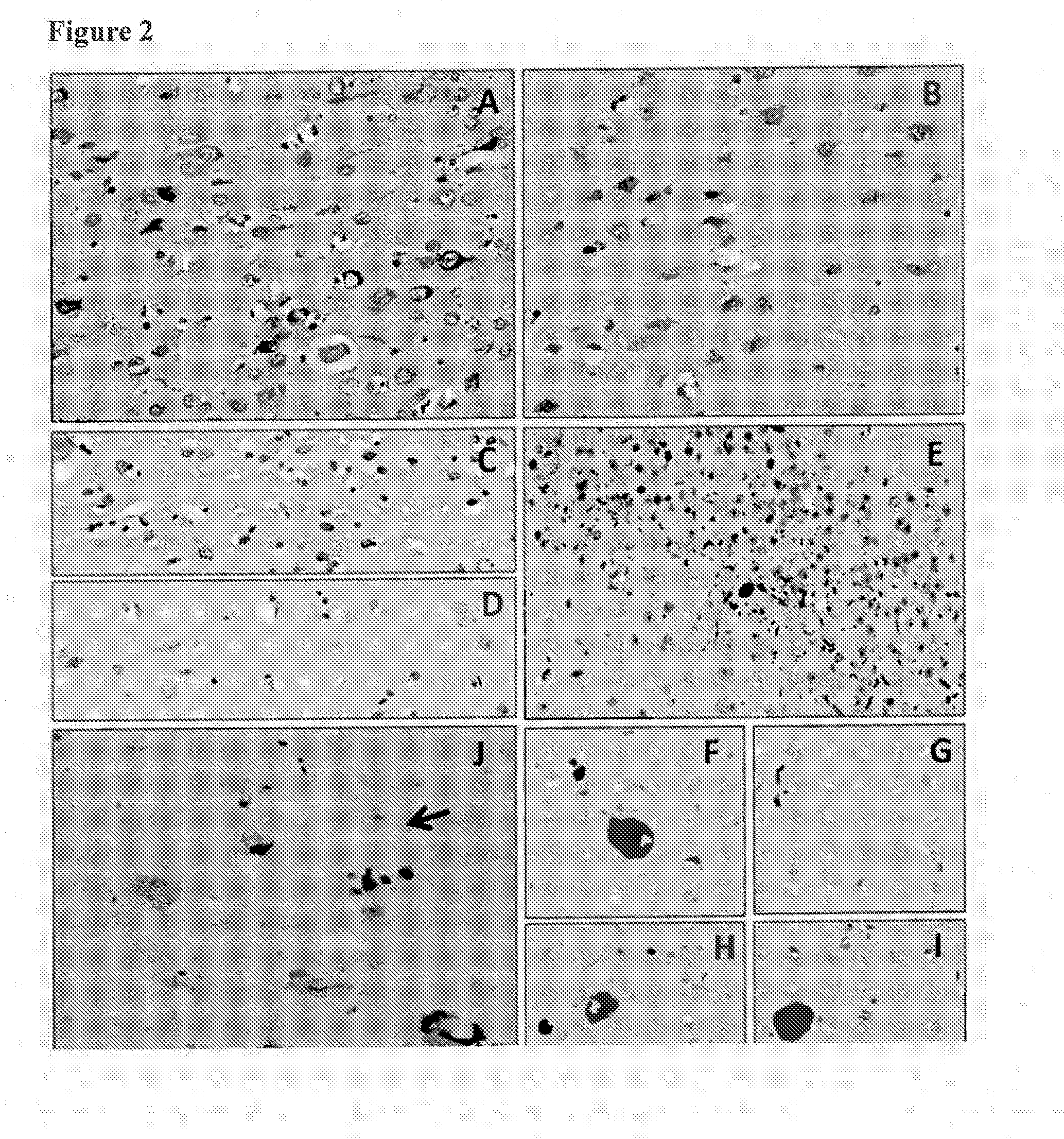 Human Anti-tau antibodies