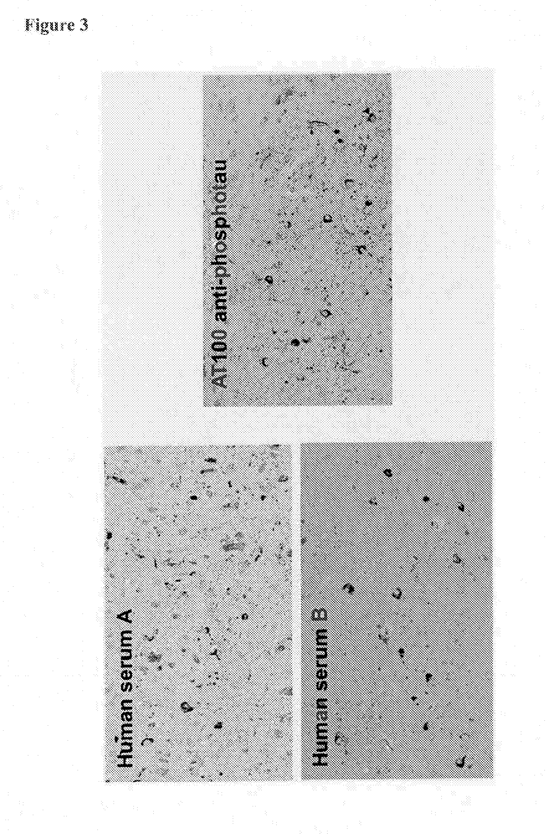 Human Anti-tau antibodies