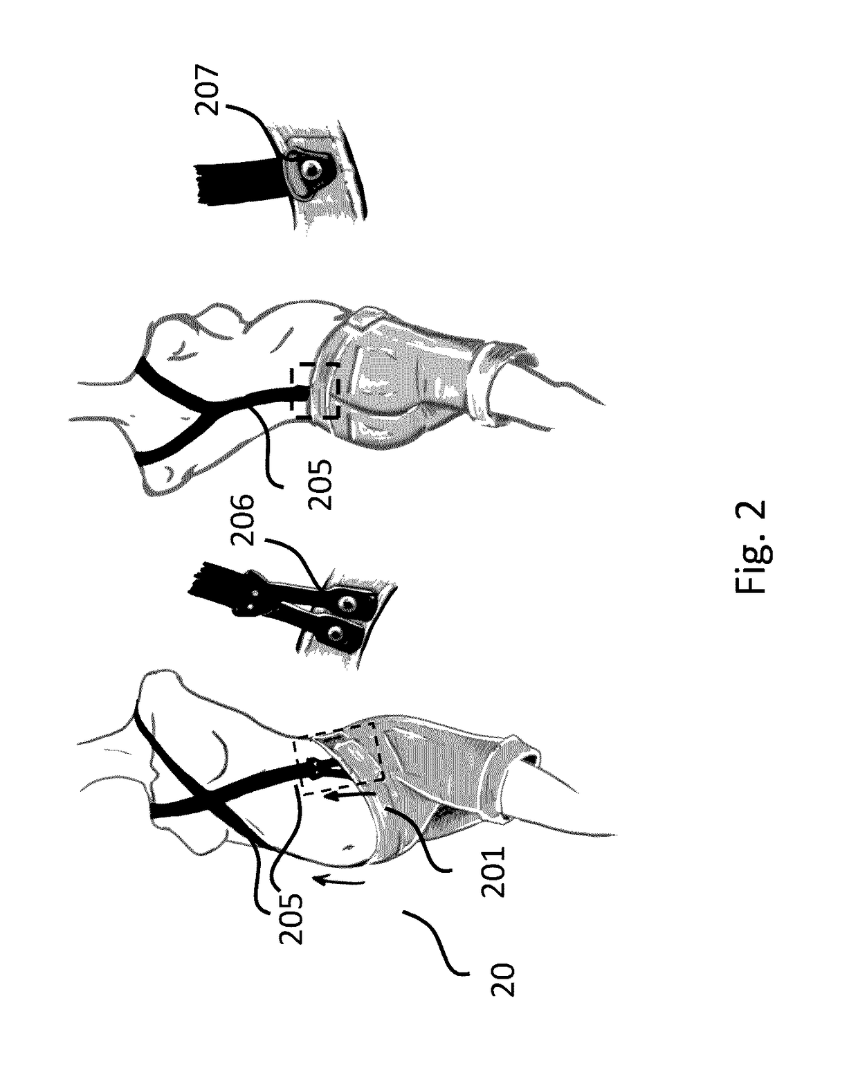 Integrated supportive device in garments