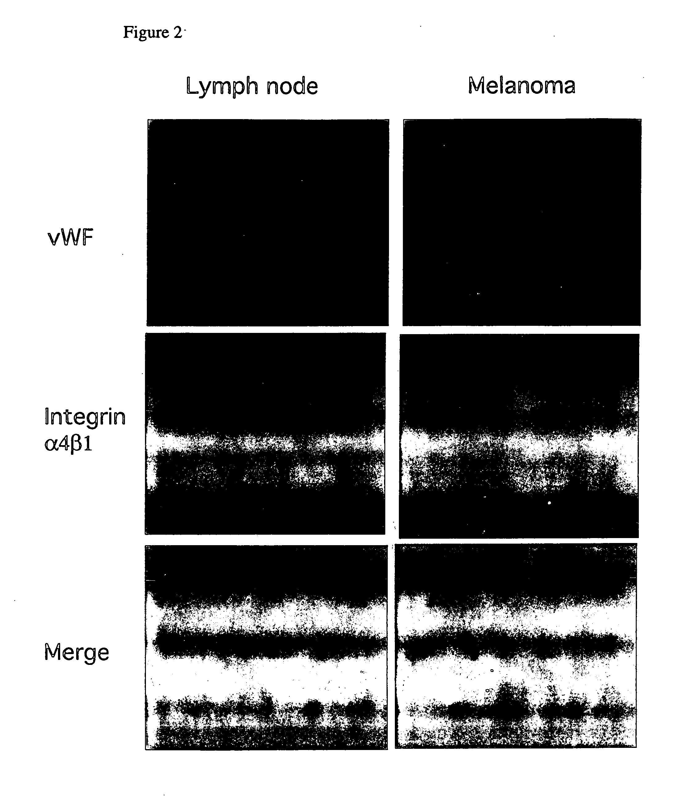 Methods for inhibiting angiogenesis