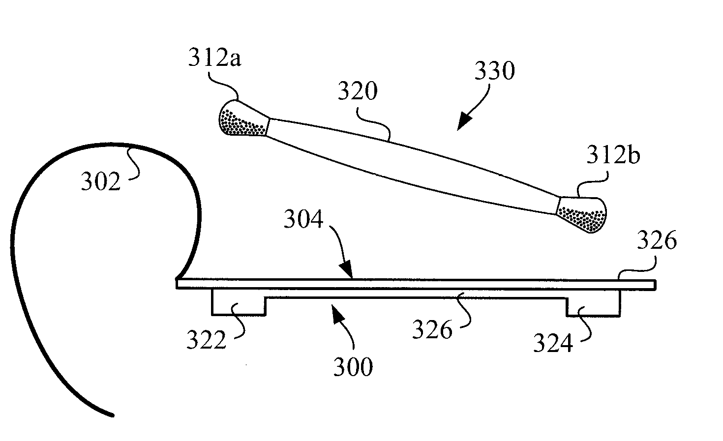 Wound Closure Adhesive Remover