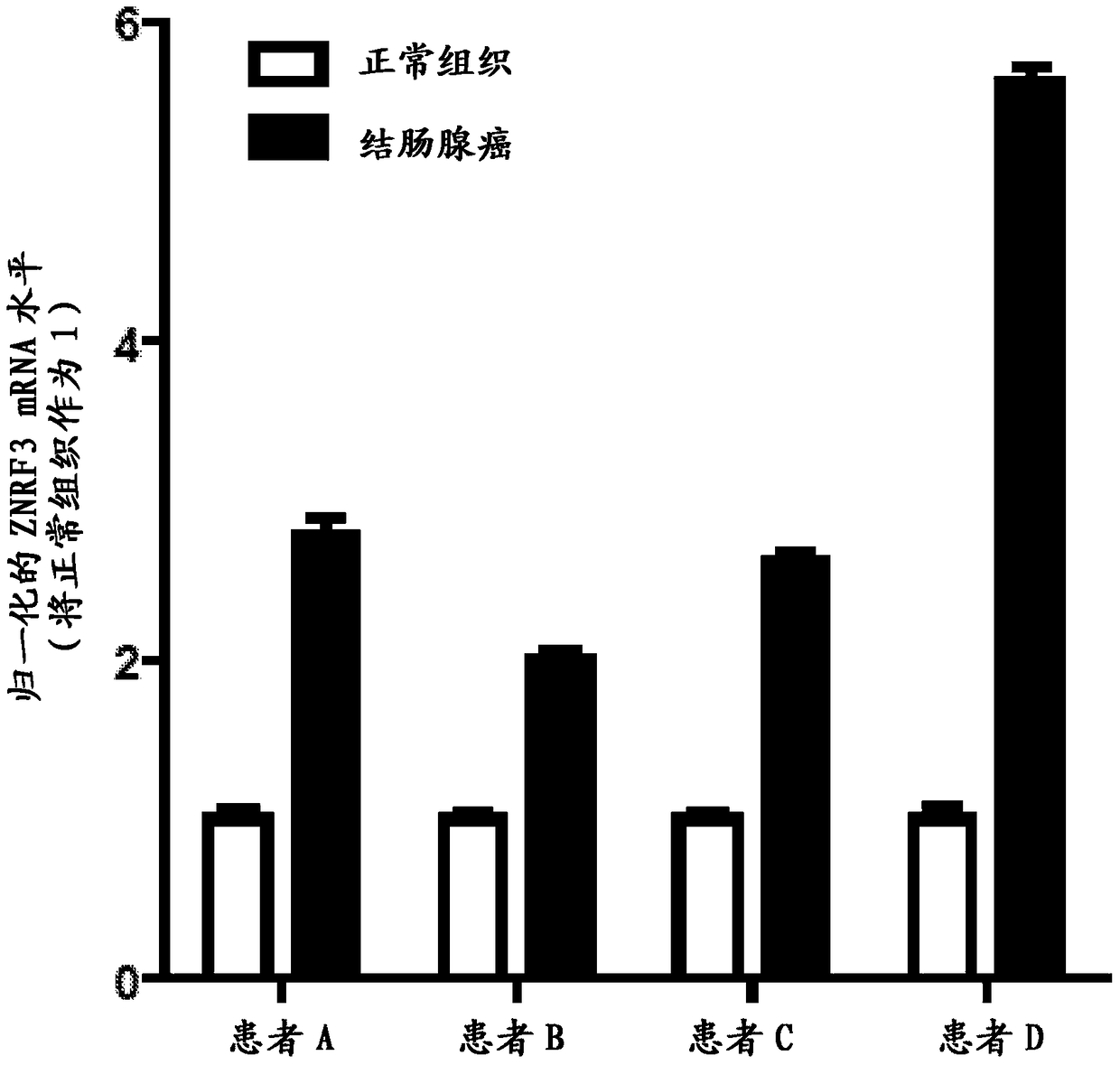 Antibodies and methods for wnt pathway related diseases