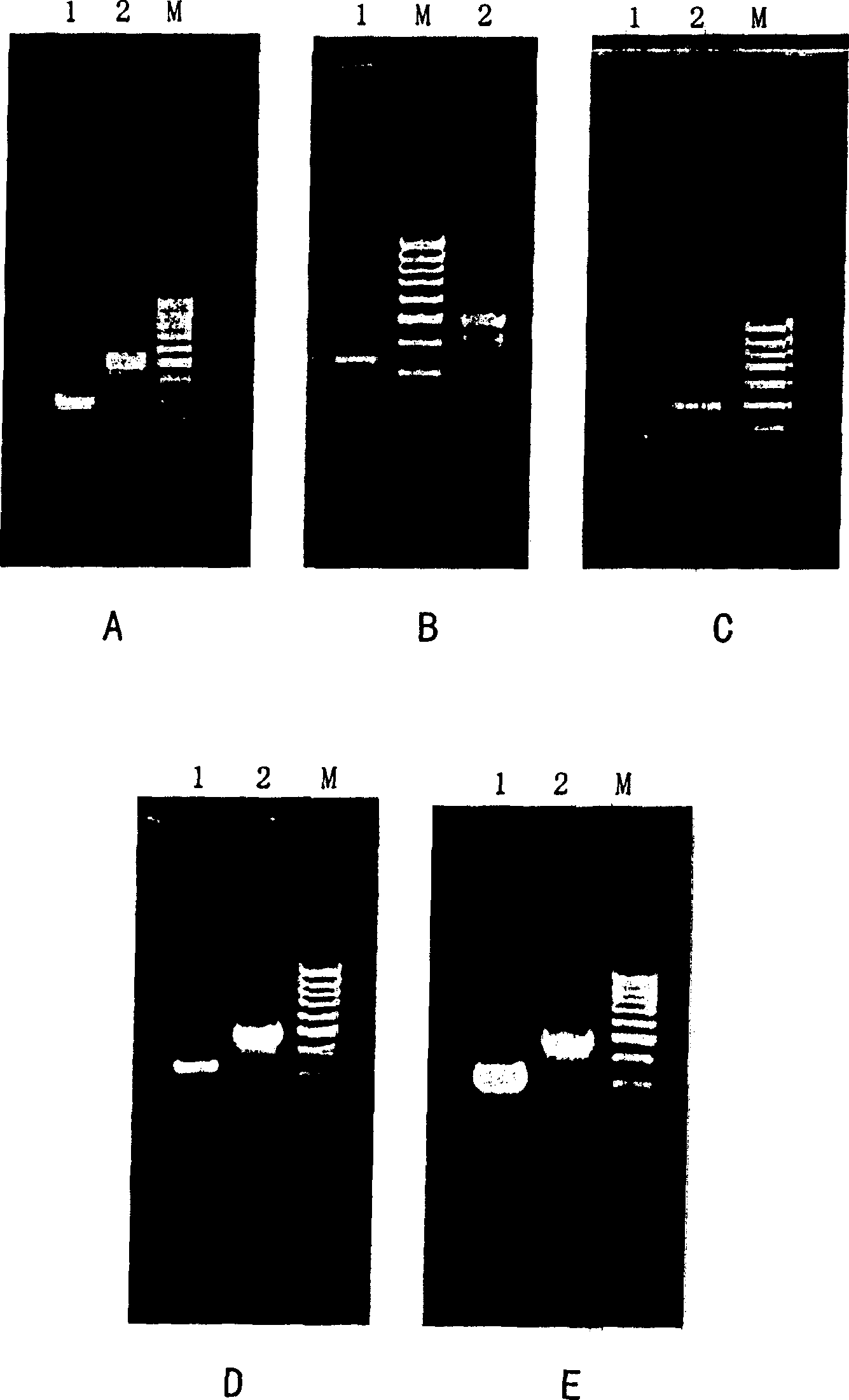 Fluorogenic quantitative PCR method for detecting interleukin 2 gene expression in peripheral-blood under physiological state