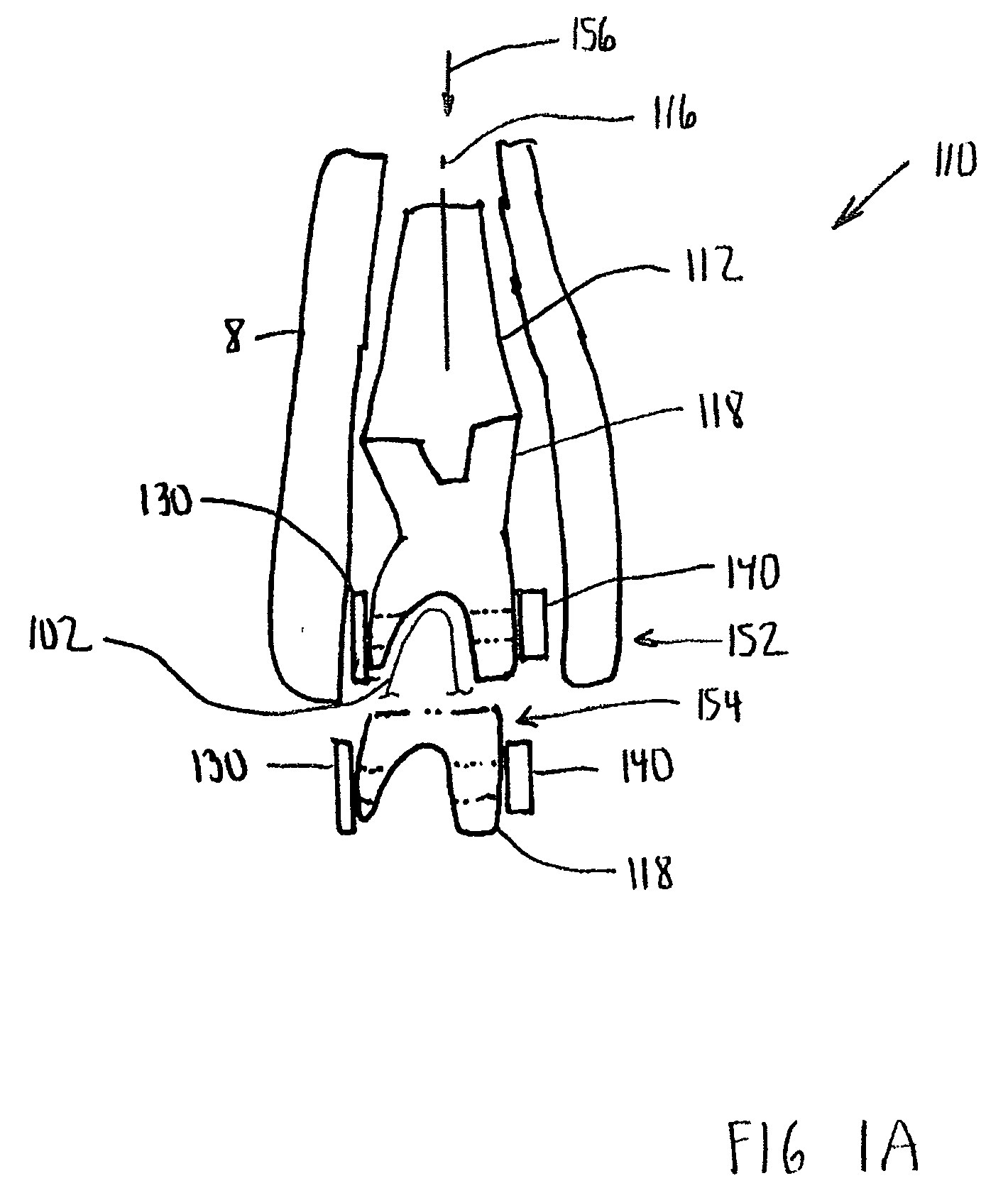 Modular total elbow humeral component and associated methods