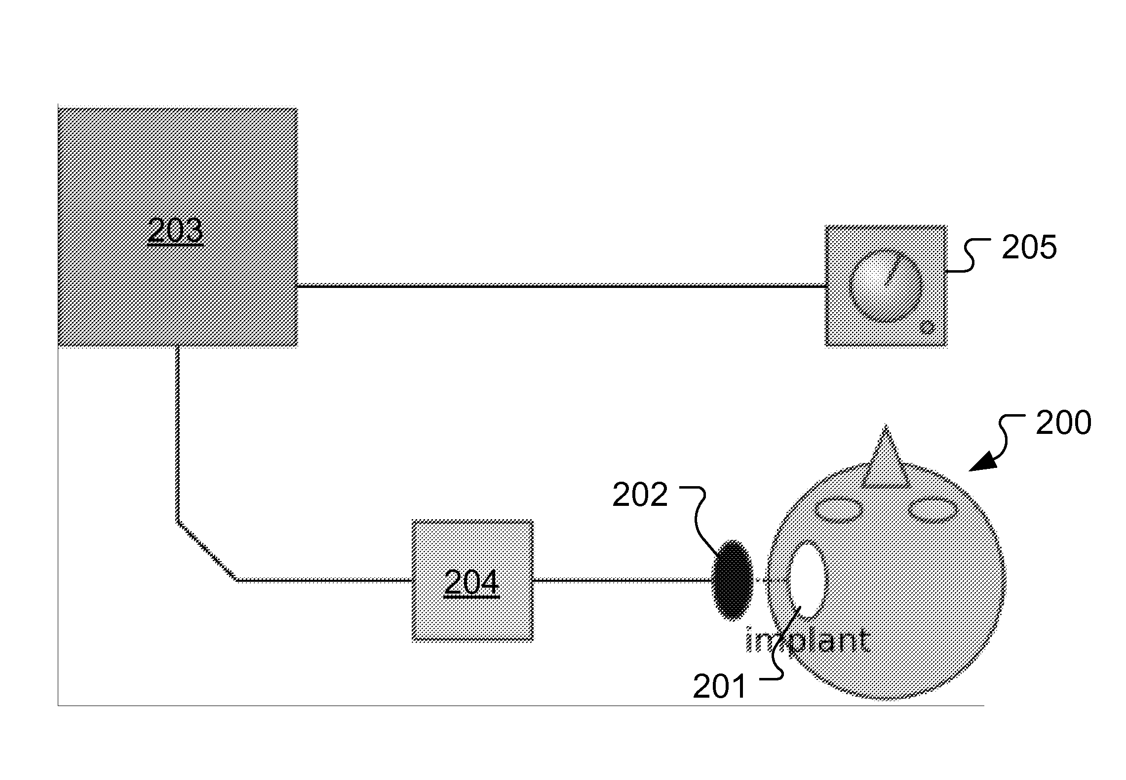 Method For Fitting A Cochlear Implant With Patient Feedback