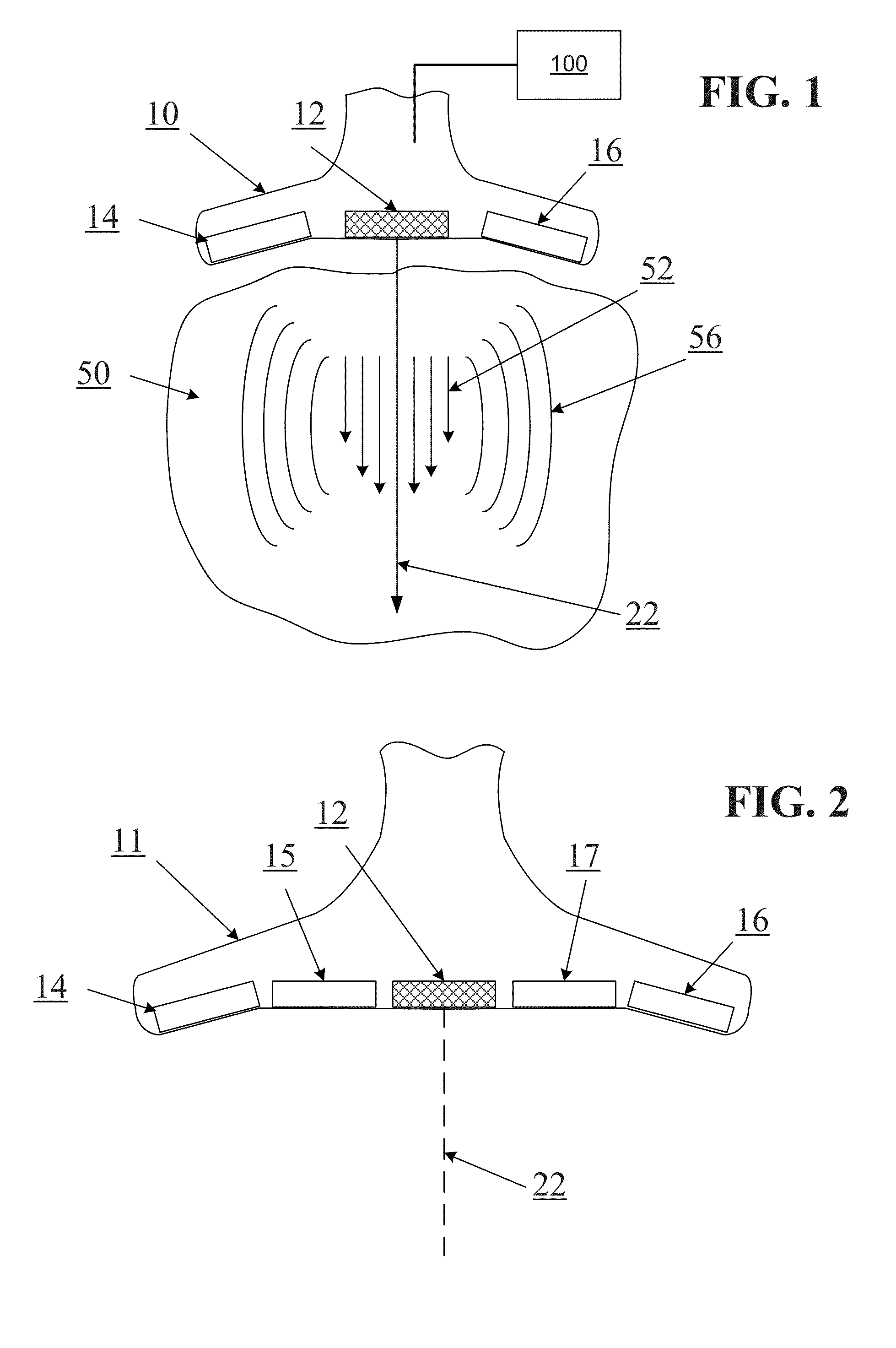 Determining material stiffness using multiple aperture ultrasound