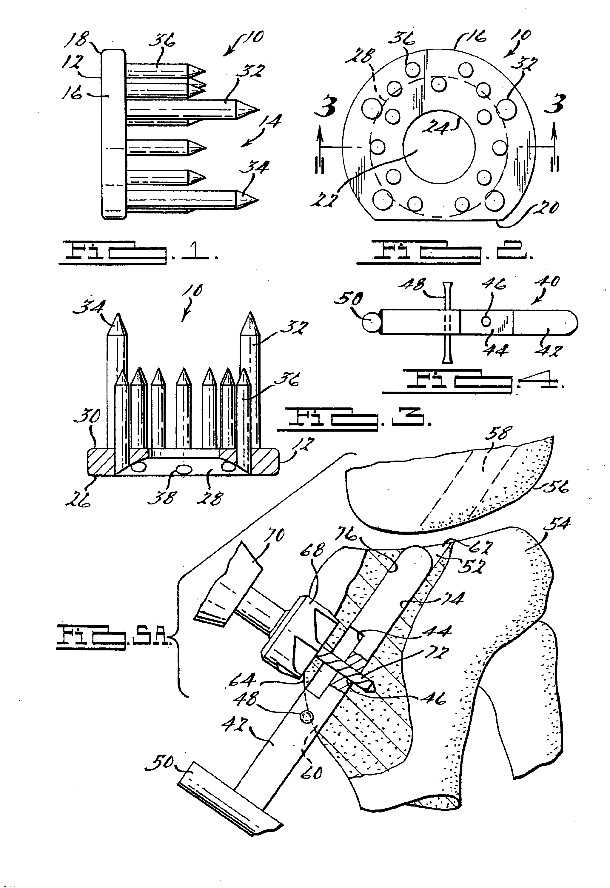 Apparatus and Method for Tibial Fixation of Soft Tissue