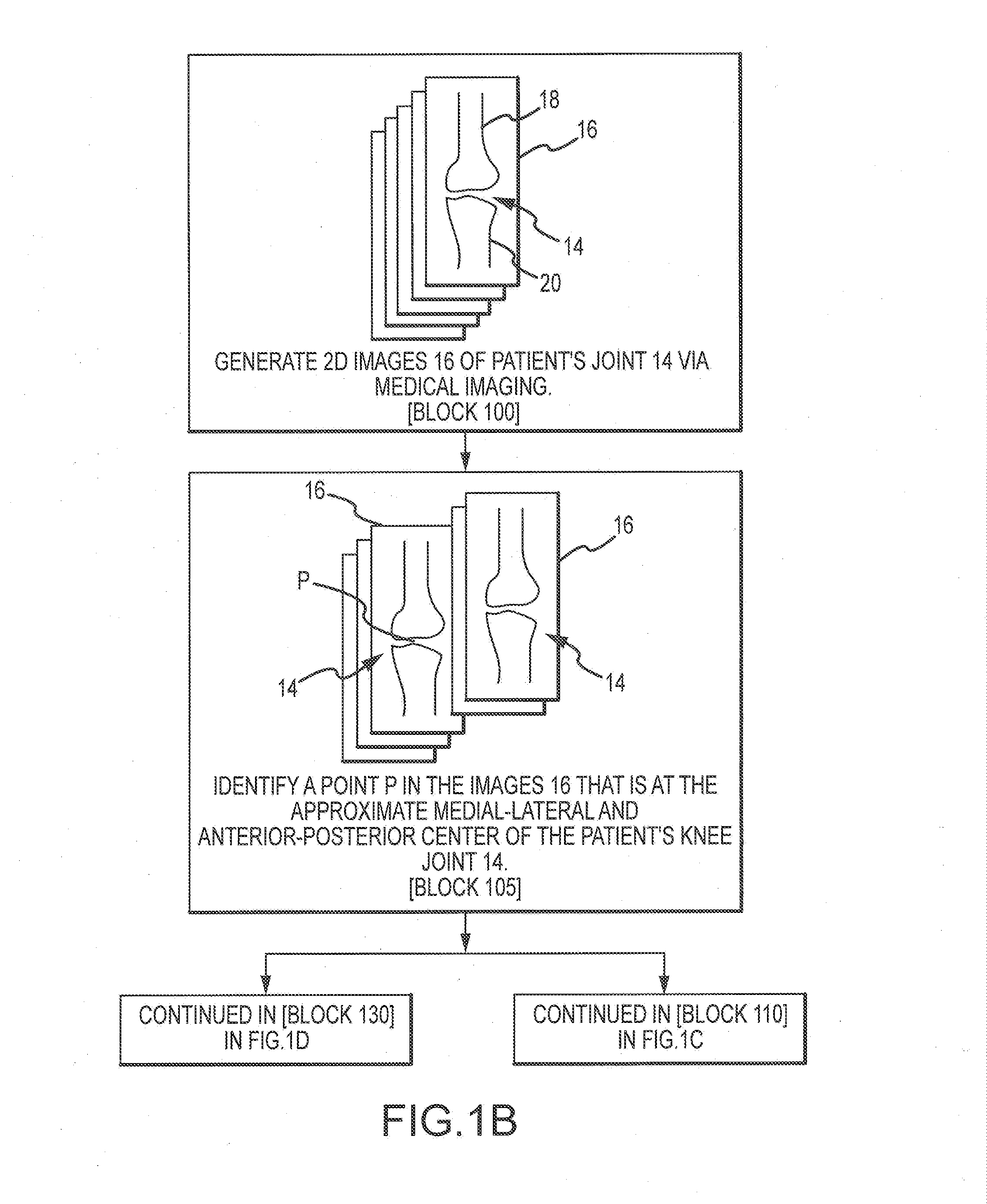 System and method for manufacturing arthroplasty jigs having improved mating accuracy