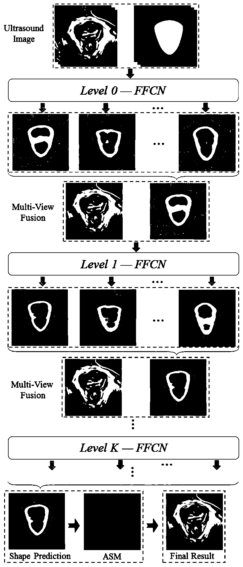 Method, device and electronic device for identifying levator ani hiatus