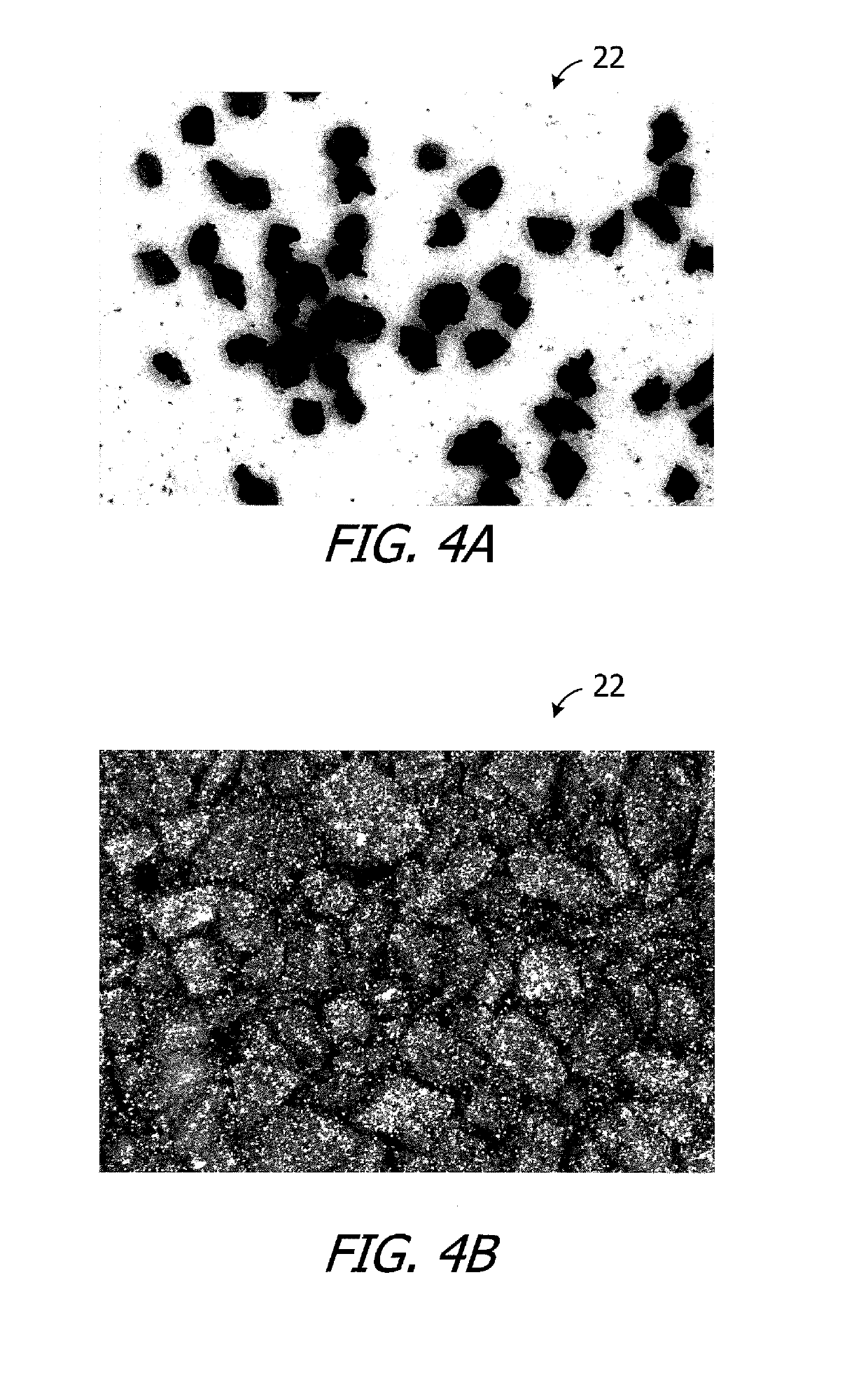 Cochlear implants having MRI-compatible magnet apparatus and associated methods