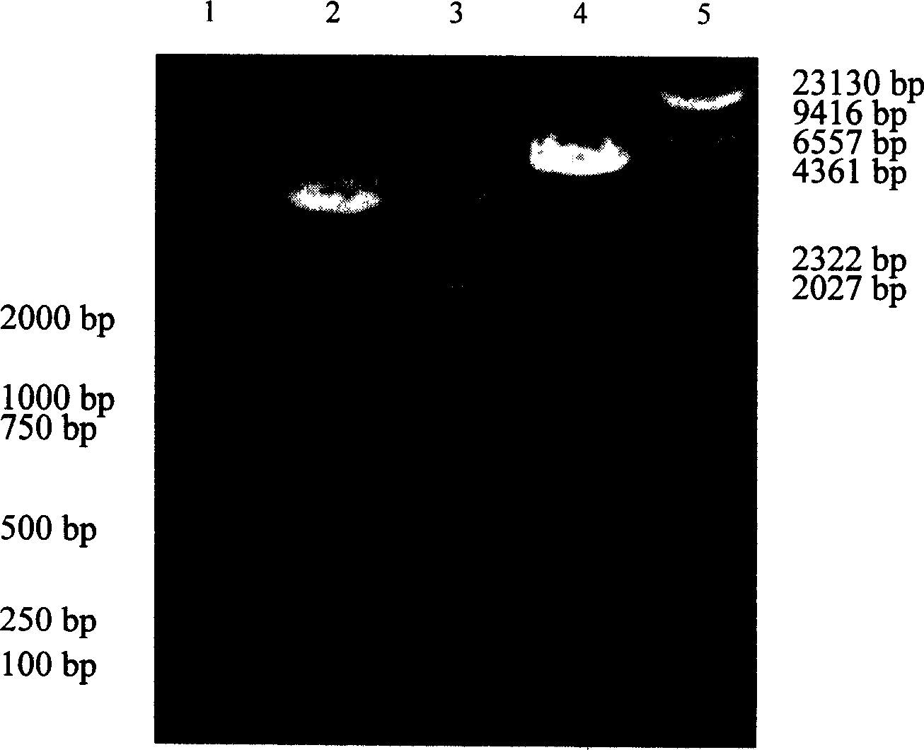 Targeted anticarious DNA vaccine and peparation thereof