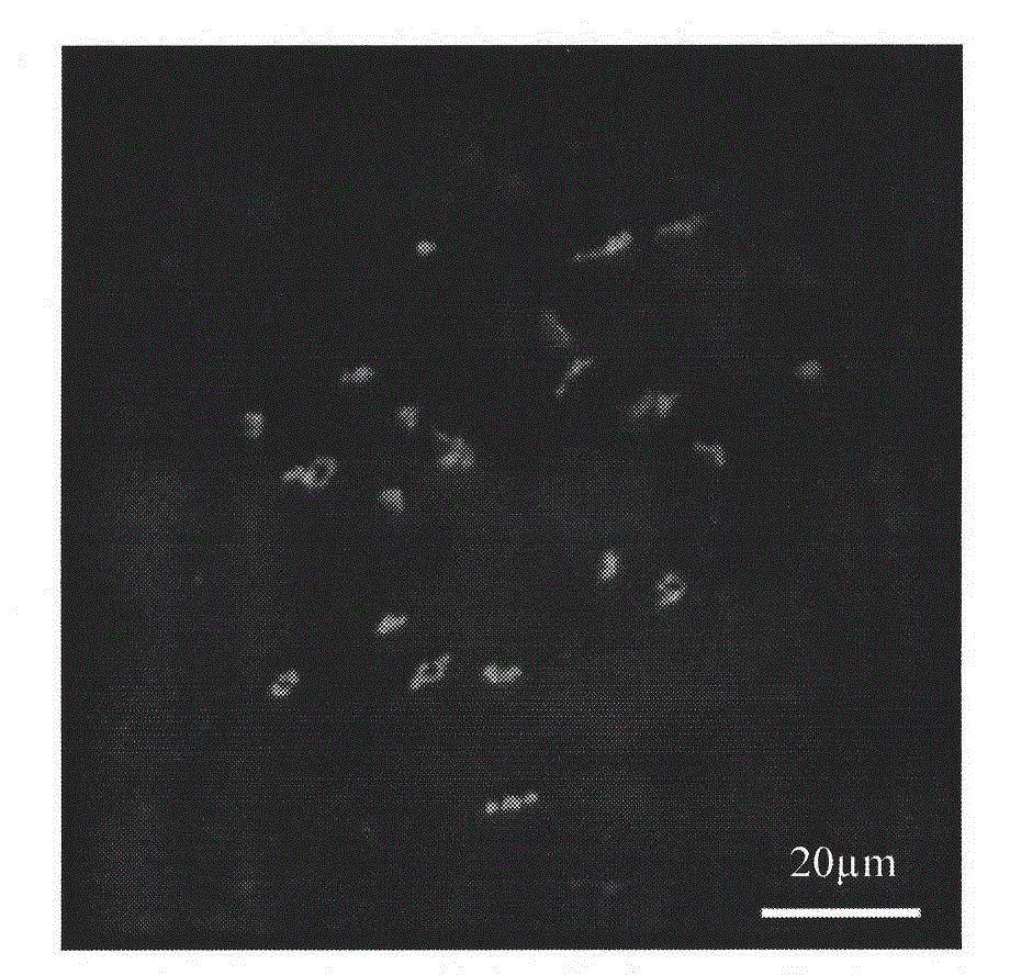 Method for preparing fish ovary germ cell chromosome