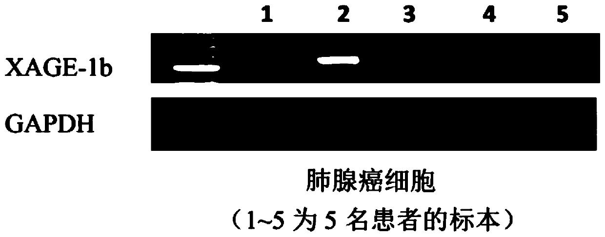 Tumor-associated antigen XAGE-1b nonapeptide and application thereof