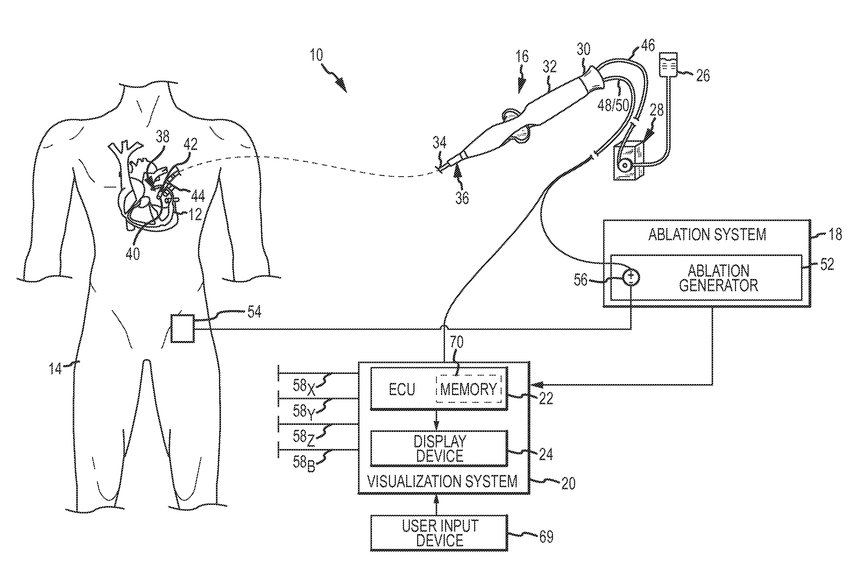 System and method for presenting information representative of lesion formation in tissue during an ablation procedure