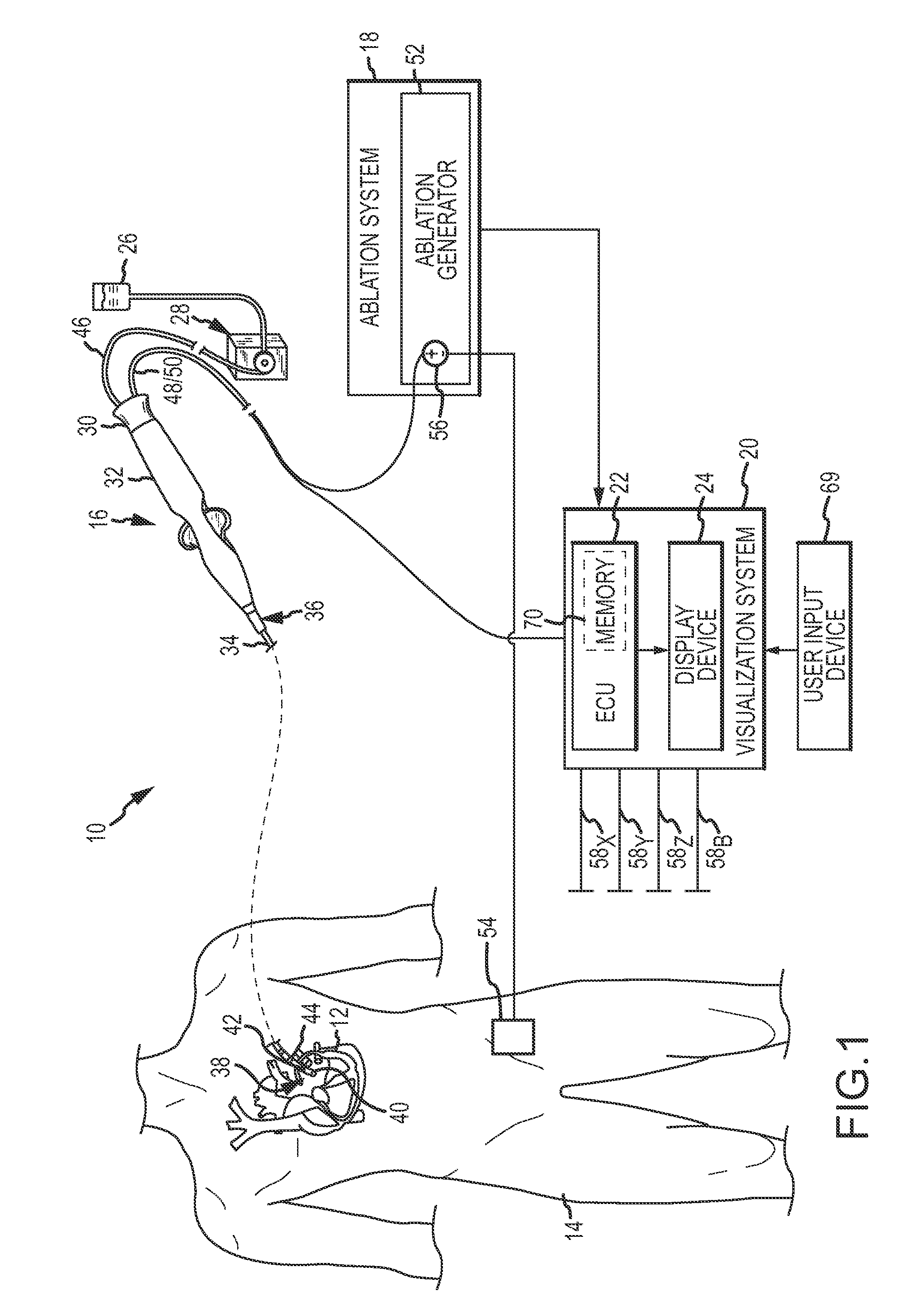 System and method for presenting information representative of lesion formation in tissue during an ablation procedure