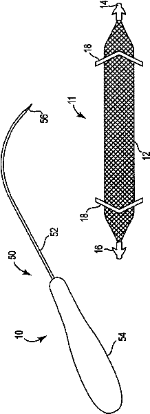 Pelvic implant system and method