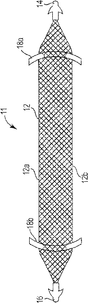 Pelvic implant system and method