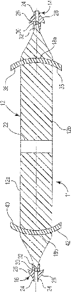 Pelvic implant system and method