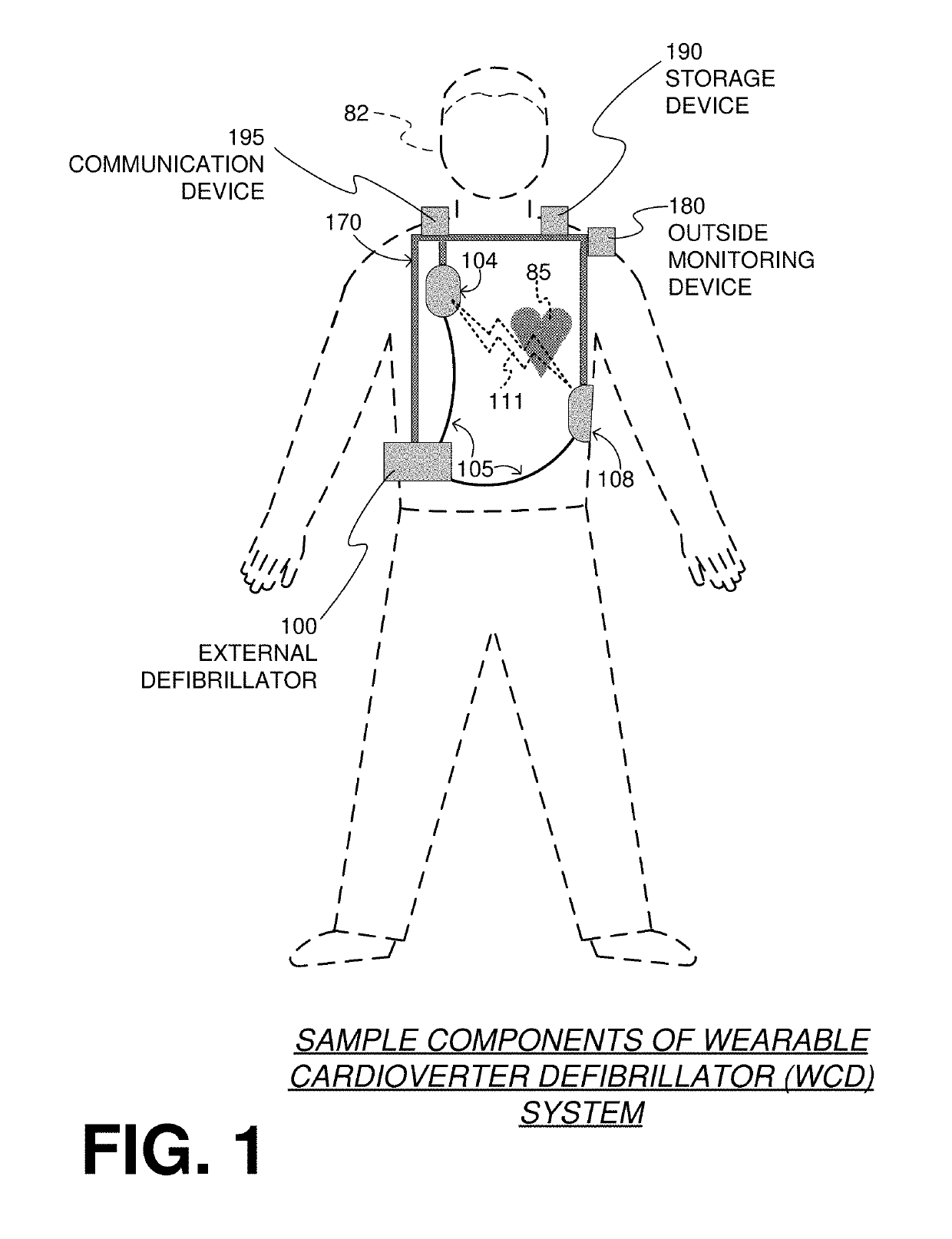 Wearable cardioverter defibrillator (WCD) system logging events and broadcasting state changes and system status information to external clients