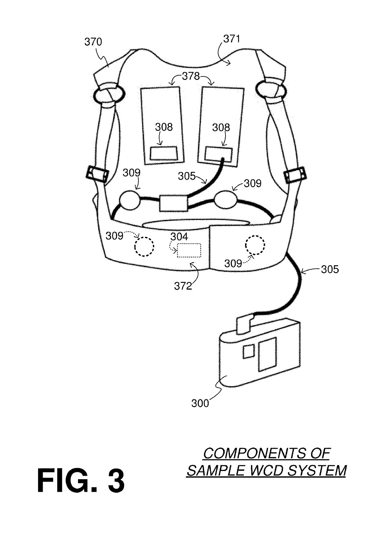 Wearable cardioverter defibrillator (WCD) system logging events and broadcasting state changes and system status information to external clients