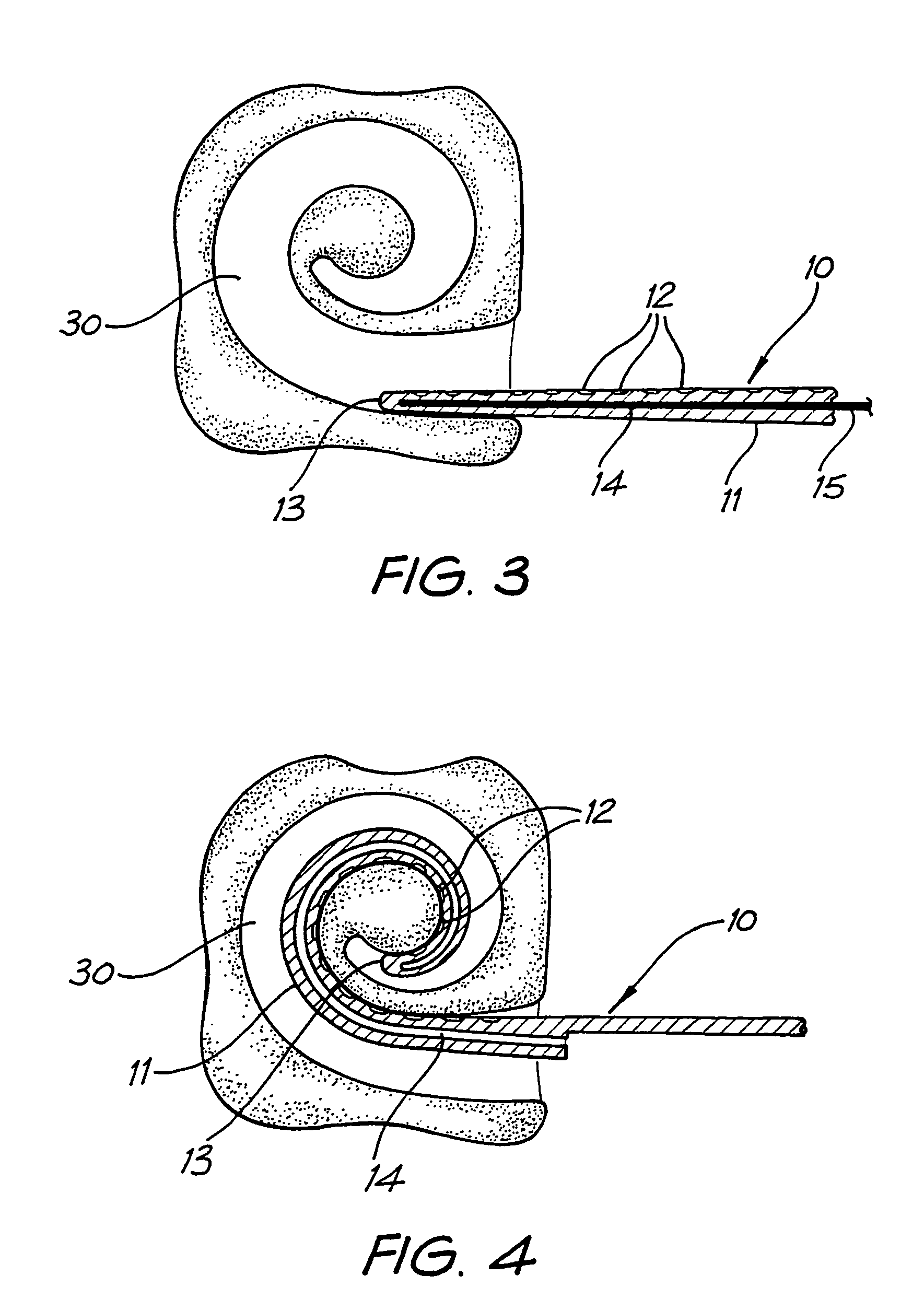 Cochlear implant electrode array