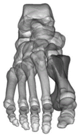 Organ positioning method based on sectional image reconstruction