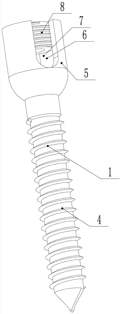 Fixing device for repairing broken wall of spinal pedicle