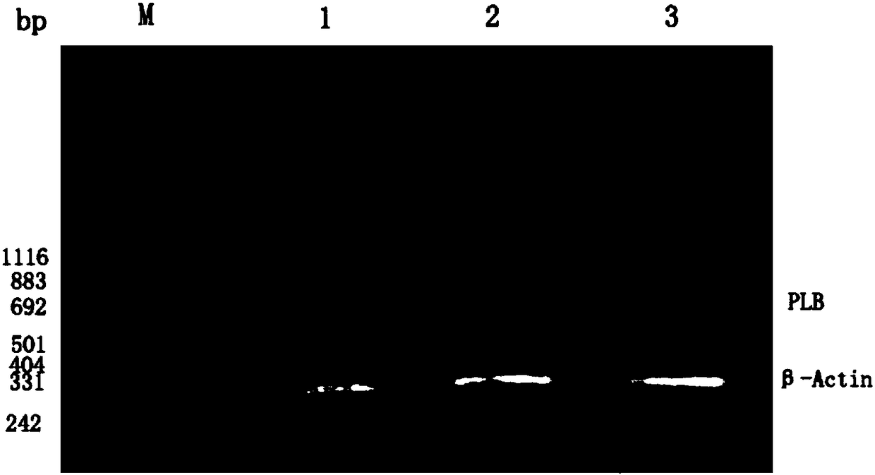 Phospholamban gene anti-sense RNA recombinant AAV vector, virus, construction method and application