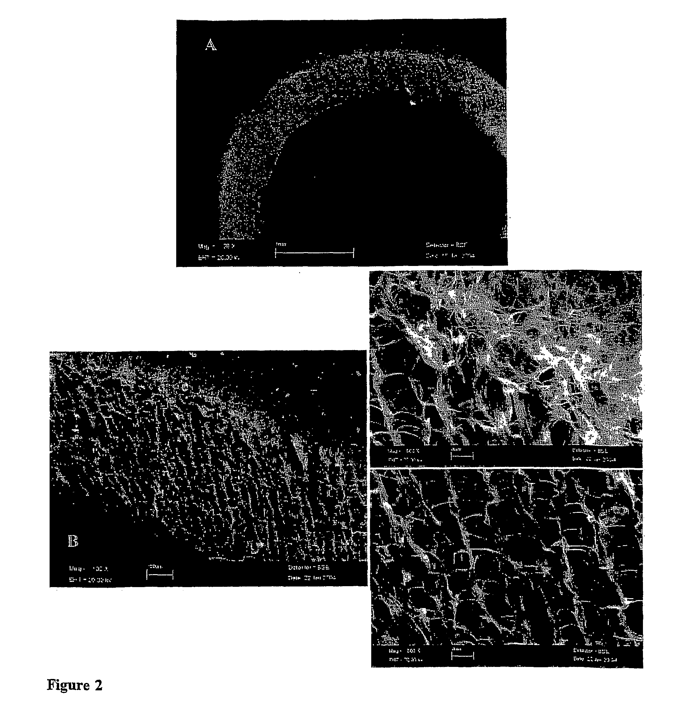 Novel Technique to Fabricate Molded Structures Having a Patterned Porosity