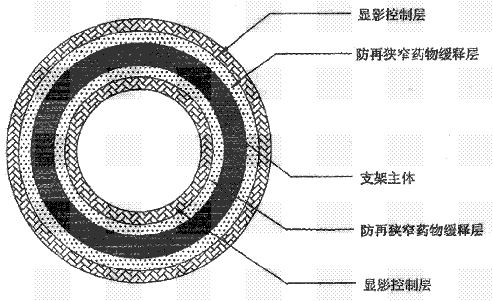 Biodegradable bracket with multiple drugs