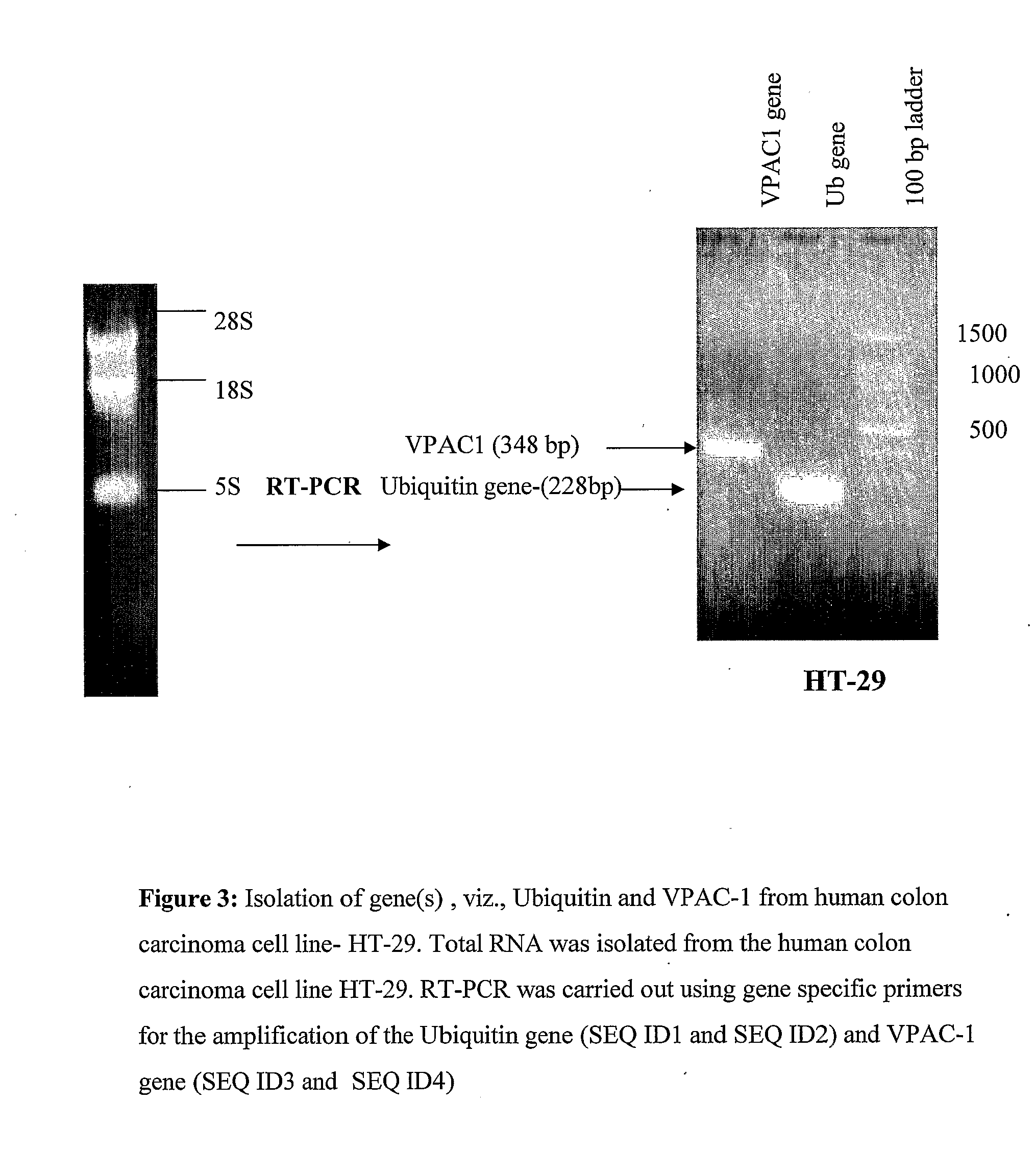 DNA Vaccine for Cancer Therapy