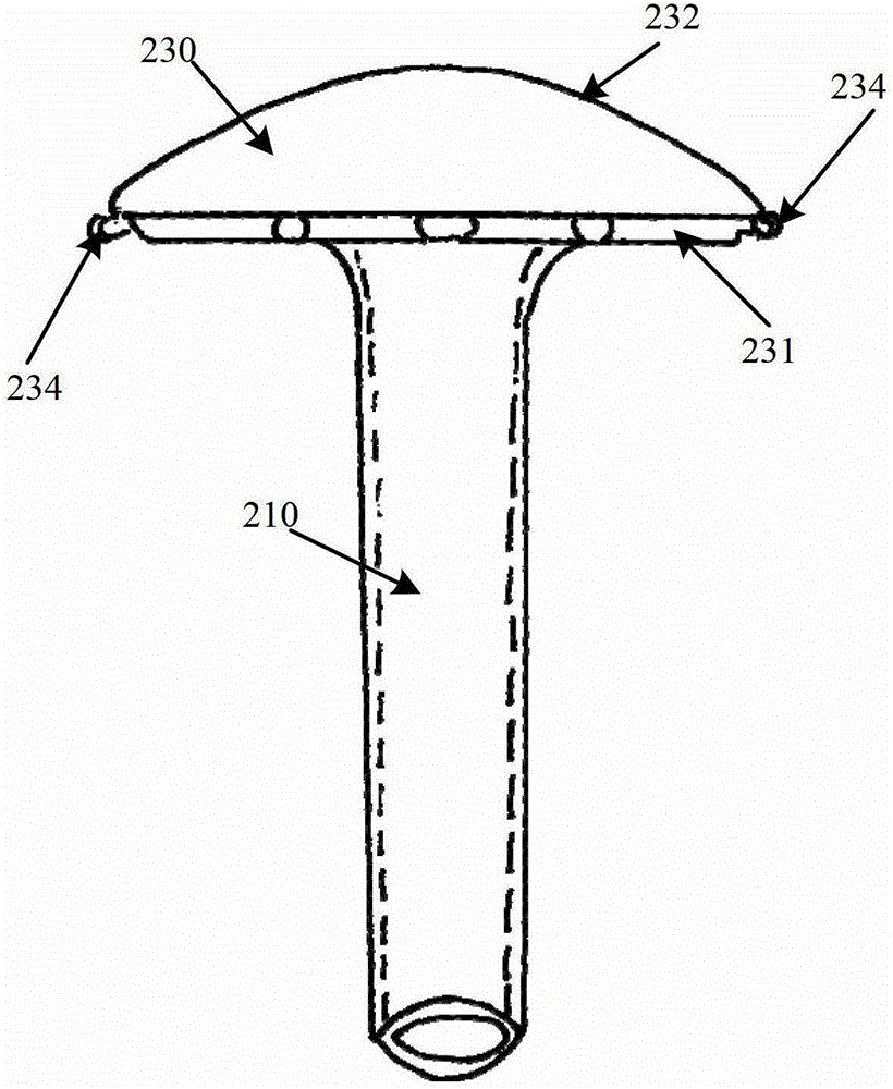 Rear-mounted stress-type glaucoma drainage valve