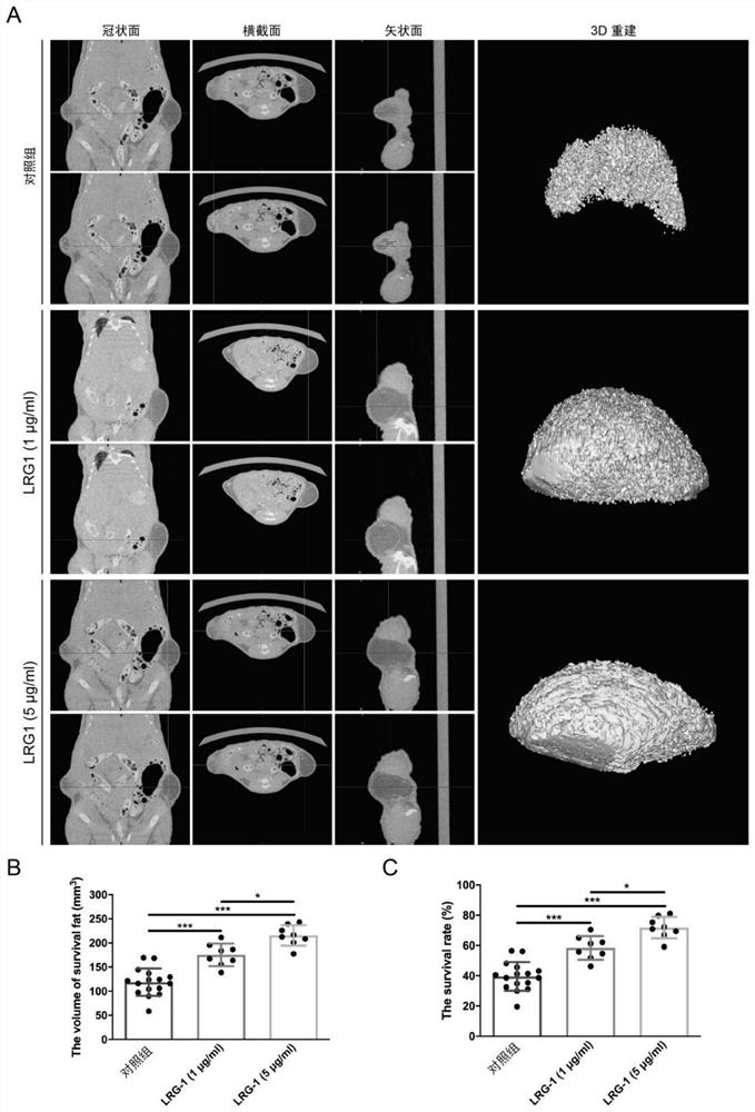 Application of LRG1 gene or protein coded by LRG1 gene in preparation of medicine for reducing autotransplantation fat cell apoptosis