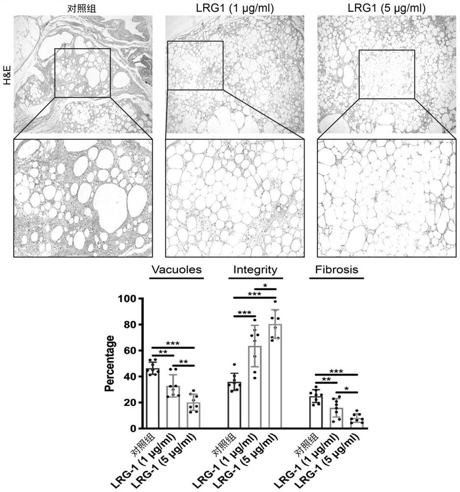 Application of LRG1 gene or protein coded by LRG1 gene in preparation of medicine for reducing autotransplantation fat cell apoptosis