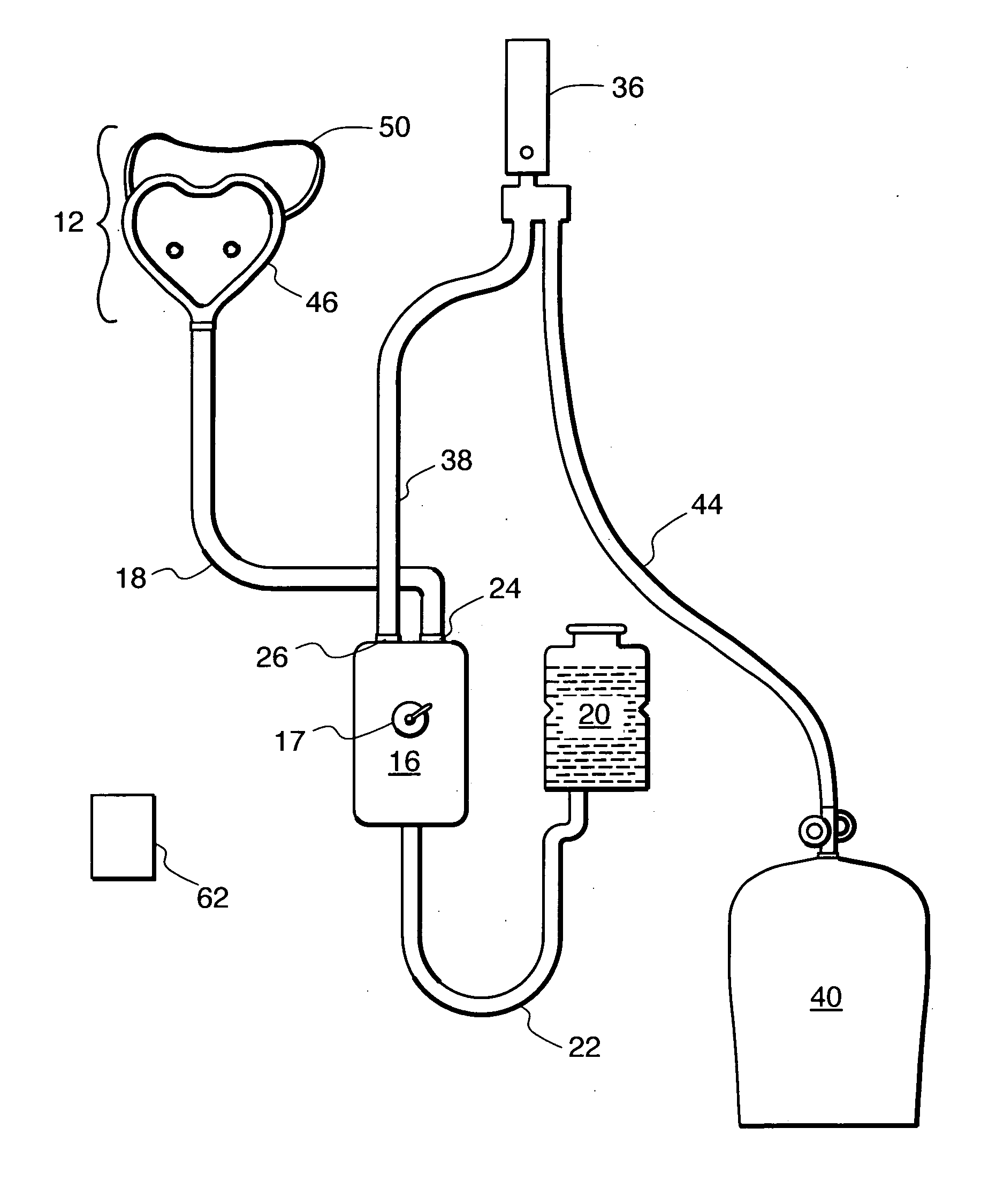 High-flow oxygen delivery system and methods of use thereof