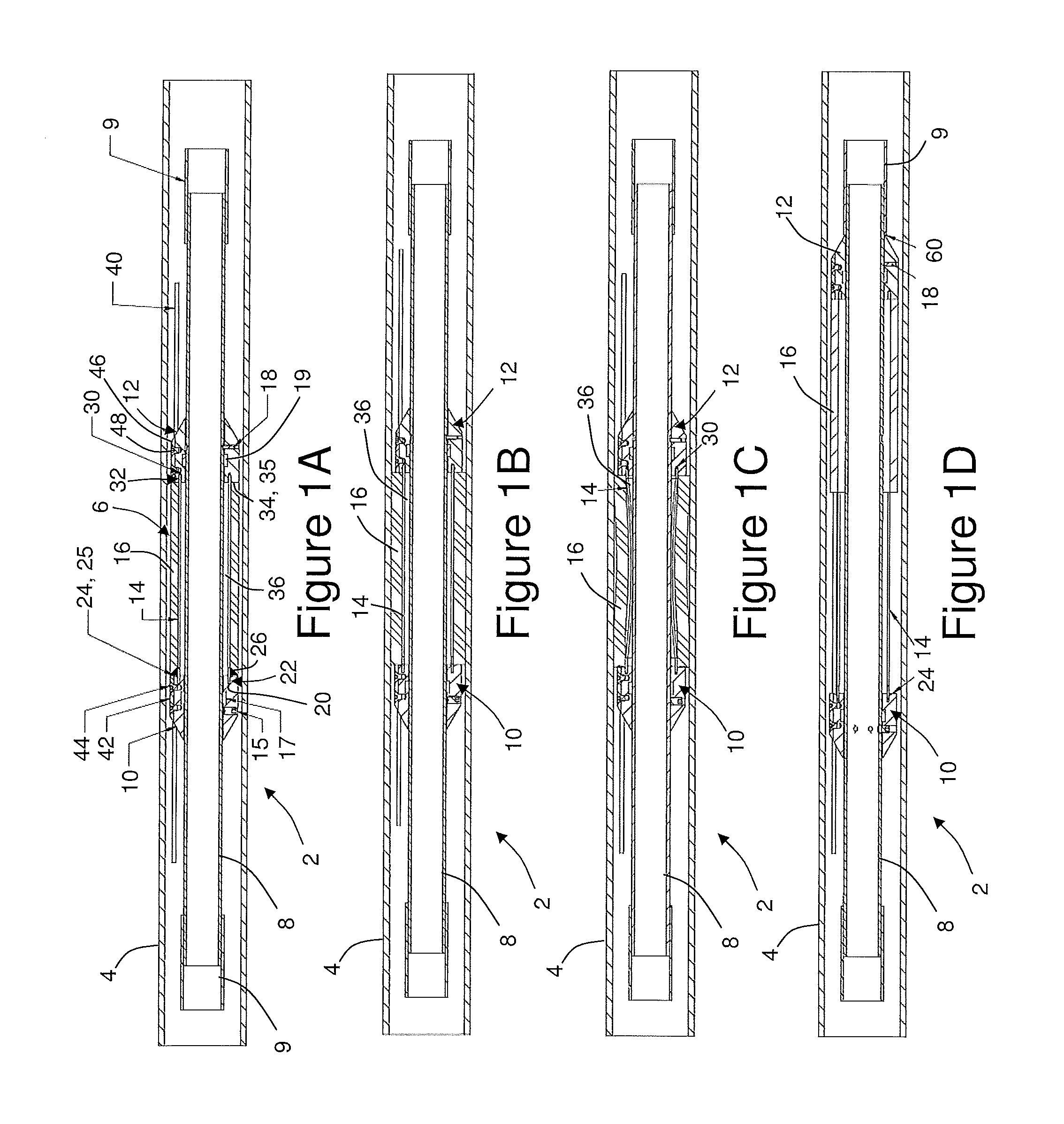 Retrievable packer