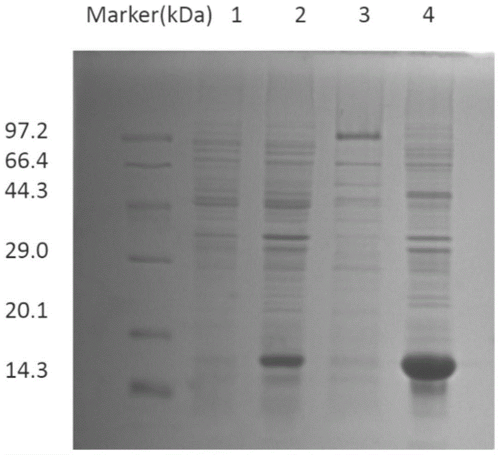 Anti-human β2 microglobulin single domain antibody and its preparation method and use