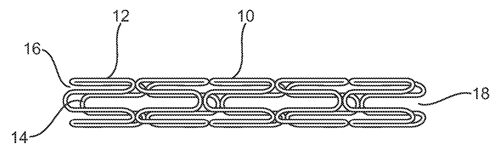 Medical Devices to Prevent or Inhibit Restenosis