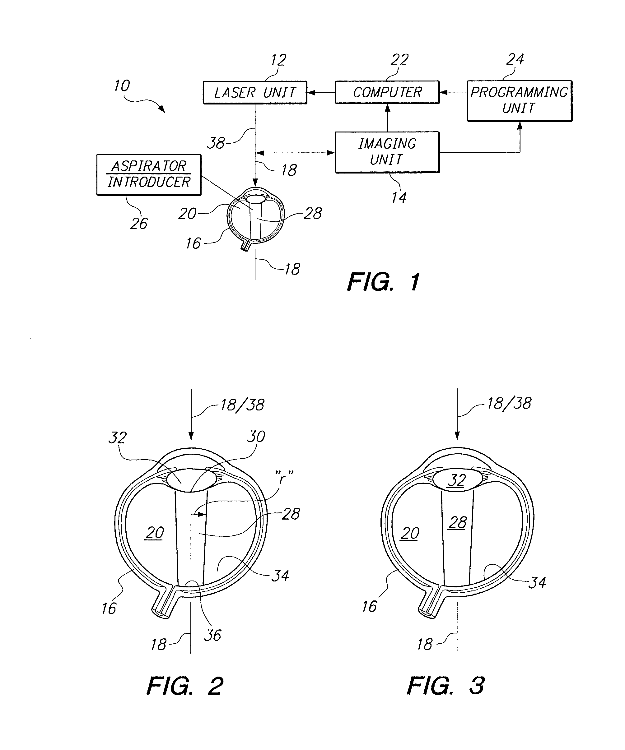 Treatment Systems for Vitreous Floaters