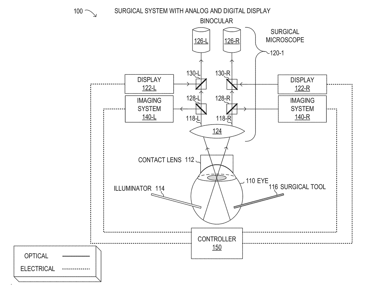 Optical and digital visualization in a surgical microscope