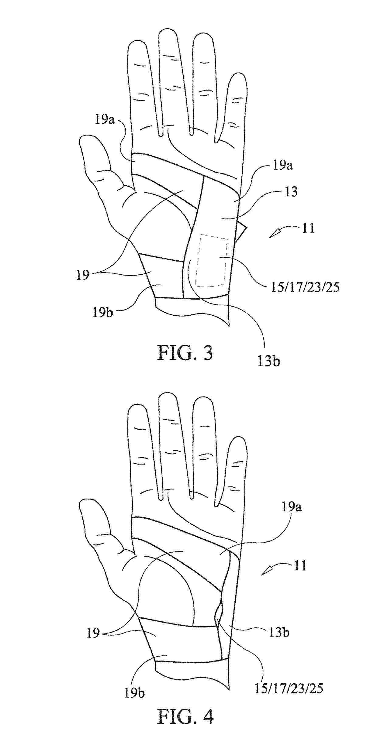 Method to stop bleeding, with short hemostasis duration using a low dose of anticoagulant