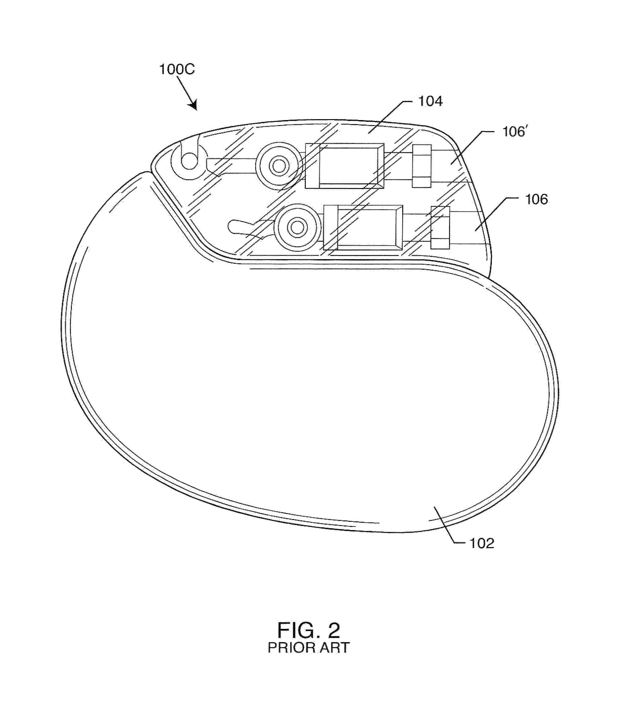 Co-fired hermetically sealed feedthrough with alumina substrate and platinum filled via for an active implantable medical device