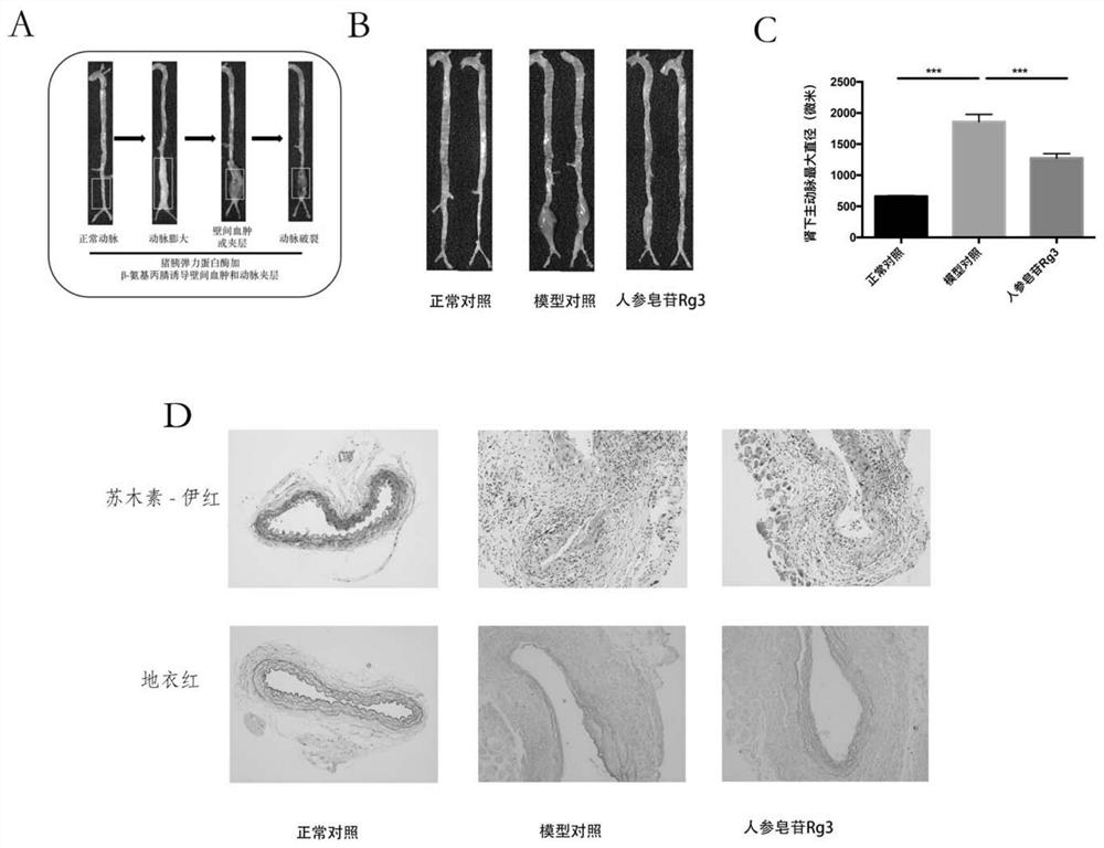 Medicine for treating artery diseases and application thereof