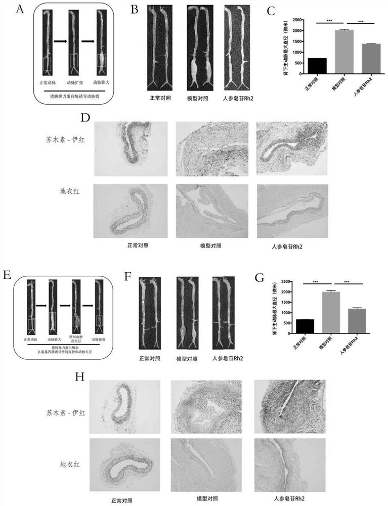 Medicine for treating artery diseases and application thereof