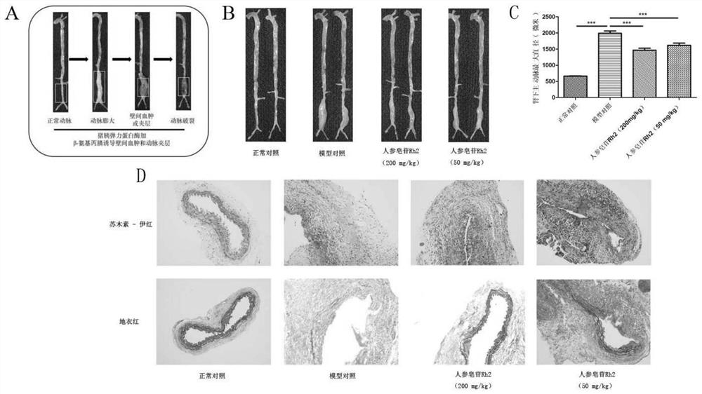 Medicine for treating artery diseases and application thereof