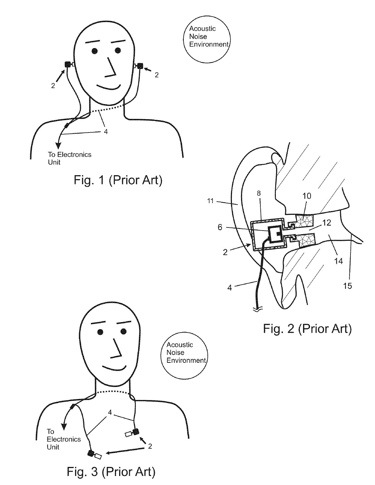 In-Ear Noise Dosimetry System