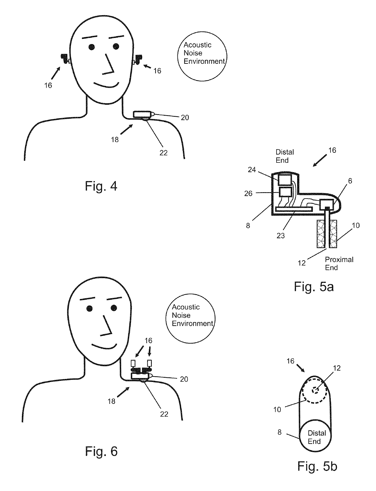 In-Ear Noise Dosimetry System