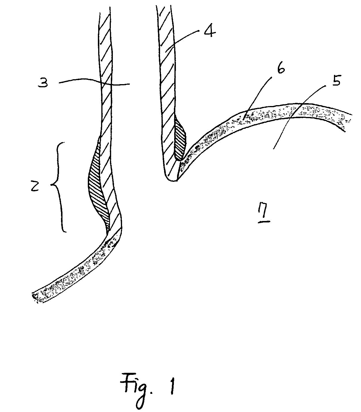 Devices and methods for fastening tissue layers