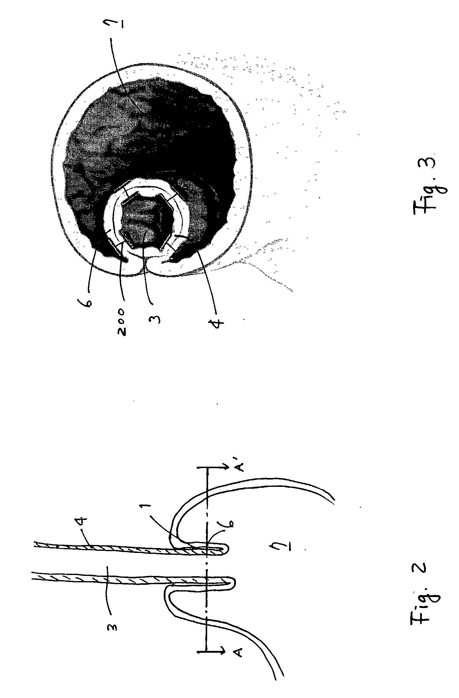 Devices and methods for fastening tissue layers