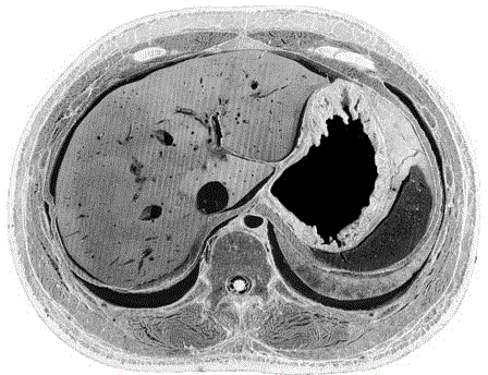 Method for manufacturing imitative sectional imaging specimen